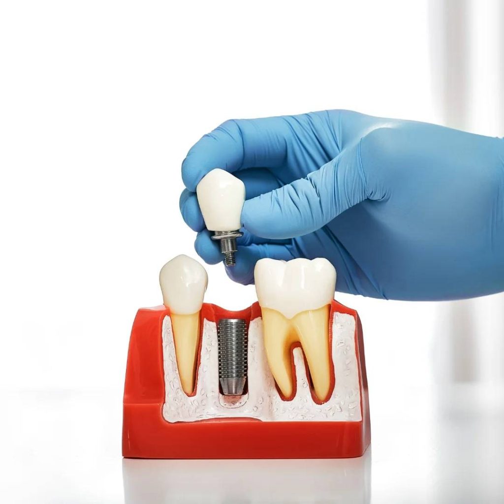 Implant Dentistry in Blenheim, ON