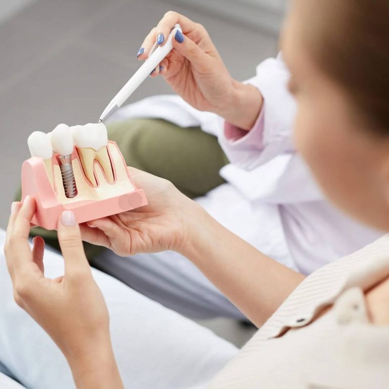 Dental Implants in Blenheim, ON