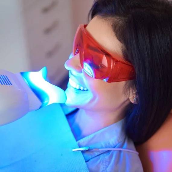 teeth whitening in Blenheim