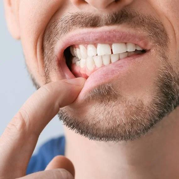 gum disease treatment in Blenheim