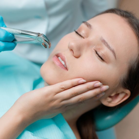 Wisdom Teeth Extraction